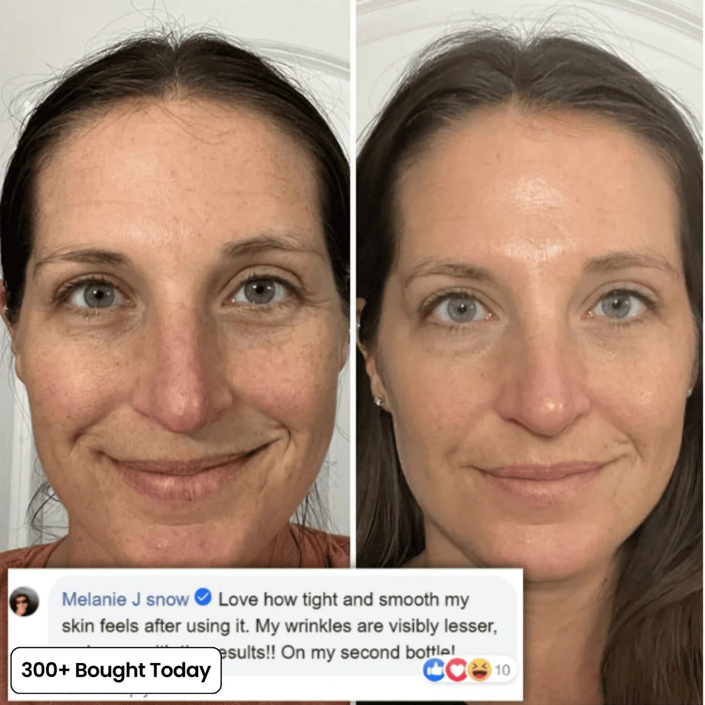 🔥LAST DAY 60% OFF Relivexia Korean Pink Collagen Volume Multi Balm