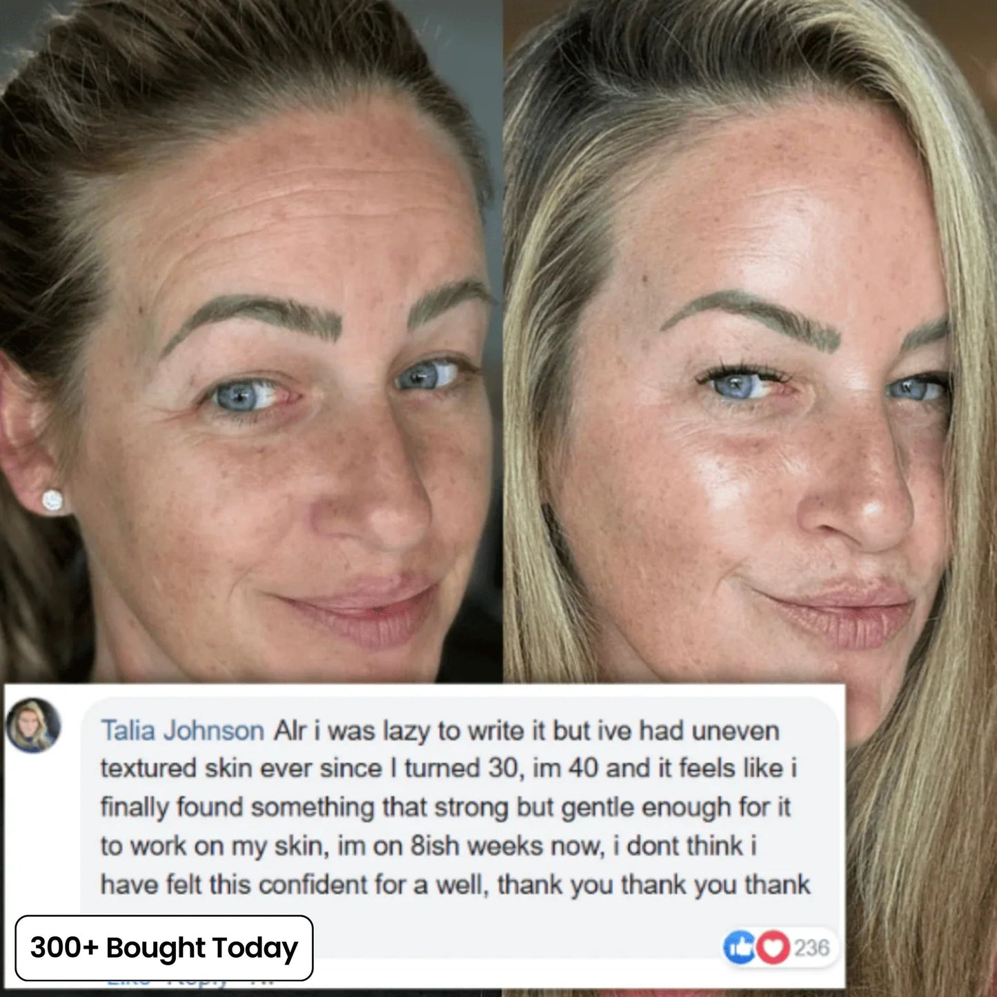 🔥LAST DAY 60% OFF Relivexia Korean Pink Collagen Volume Multi Balm