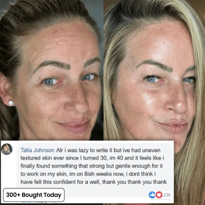 🔥LAST DAY 60% OFF Relivexia Korean Pink Collagen Volume Multi Balm