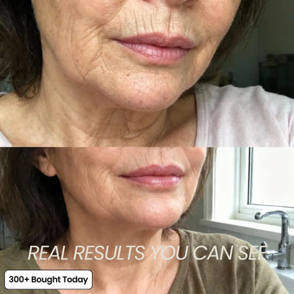 🔥LAST DAY 60% OFF Relivexia Korean Pink Collagen Volume Multi Balm