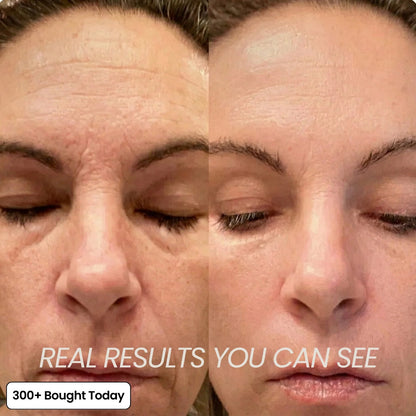 🔥LAST DAY 60% OFF Relivexia Korean Pink Collagen Volume Multi Balm
