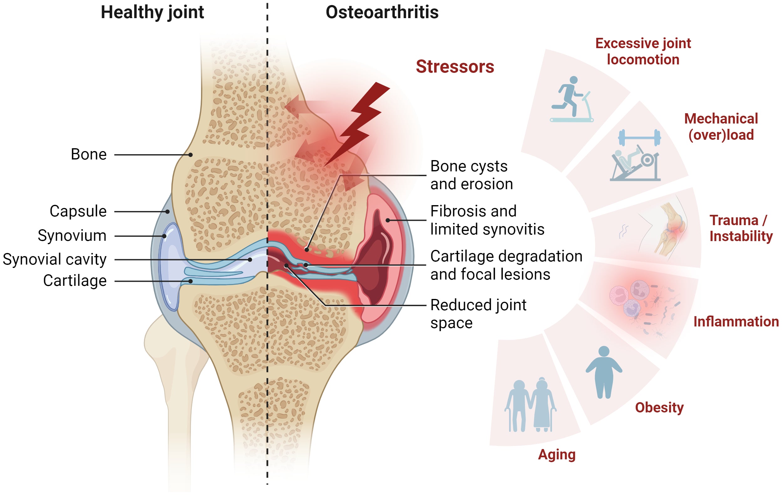 Joint pain relief